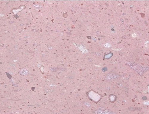CANTERA ROSA LAMINADA